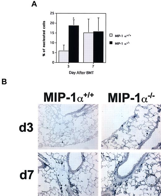 Fig. 6. Accelerated influx of cytolytic granzyme B+cells in the lungs of recipients of MIP-1α−/− spleen cells. / Frequencies of cells expressing granzyme B mRNA were determined by in situ hybridization of cryosections with digoxigenin-labeled antisense RNA probes. (A) Mean values ± SE for 4 mice per group, pooled from 2 experiments. *P < .02 vs MIP-1α+/+recipients. (B) In situ hybridizations for granzyme B for one mouse lung representative of each group shown in panel A for days 3 and 7 after BMT (× 200 magnification).
