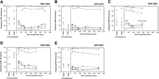 Fig. 6. NK cell receptor expression in patients from group 2 following hematopoietic cell transplantation. / Posttransplantation KIR and CD94:NKG2A NK cell expression frequencies for each of the 5 patients in group 2 are compared with donor and recipient pretransplantation expression (separate panel per patient). Patients in group 2 are characterized by depressed KIR expression and high CD94:NKG2A expression during the first year following hematopoietic cell transplantation. Symbols representing receptor-specific antibodies are the same as in Figure3.