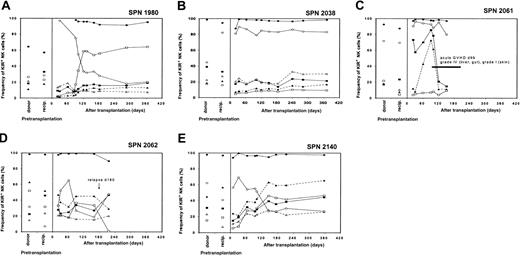 Fig. 10. NK cell receptor expression in the nongroup 1 and 2 patients following hematopoietic cell transplantation. / Posttransplantation KIR and CD94:NKG2A NK cell expression frequencies for each of the 5 remaining nongroup 1 and 2 patients are compared with donor and recipient pretransplantation expression. Each of these patients has idiosyncratic patterns of KIR reconstitution that differ from the donor and recipient following hematopoietic cell transplantation. Symbols representing each receptor-specific antibody are the same as in Figure 3.