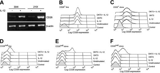Fig. 3. Effect of activation in the presence of IL-12 on transcription and re-expression of CD28 in CD4+CD28null T cells. / CD4+CD28null T cells transcribe and re-express CD28 when activated in the presence of IL-12. (A) CD4+CD28null clones were activated with anti-CD3 mAb in the presence (+) or absence (−) of IL-12 (10 ng/mL), and the transcription of CD28 was analyzed by RT-PCR (clones 304I and 210I are shown). (B-F) Re-expression of CD28 was confirmed by flow cytometry. CD4+CD28null T-cell clones (panels E-F) and lines (panel D) were stimulated with anti-CD3 mAb, IL-12, or a combination of anti-CD3 mAb and IL-12. Cells were analyzed by 4-color flow cytometry after 5 to 6 days; representative histograms are shown. The combination of anti-CD3 mAb and IL-12 induced CD28 expression in 5 of 11 lines and 6 of 13 clones. In contrast, the levels of CD28 expression were not affected in CD4+CD28+ T-cell clones or lines (panels B-C). In all histograms, the shaded areas represent staining with an isotype control.