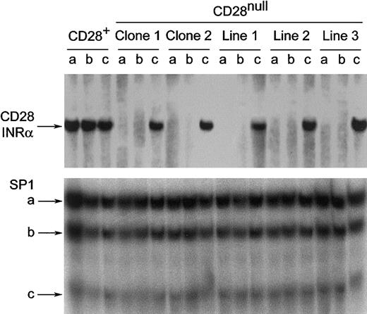 Fig. 5. How stimulation of CD4+CD28nullT cells in the presence of IL-12 affects the CD28 transcriptional initiator protein complex. / Stimulation of CD4+CD28null T cells in the presence of IL-12 restores the CD28 transcriptional initiator protein complex. Nuclear extracts from CD4+CD28nullT-cell clones and lines were analyzed by electrophoretic mobility shift assays for the presence of a protein complex binding to the INRα site of the CD28 gene.2633 Binding activities were absent in anti-CD3 mAb– (a) or IL-12– (b) stimulated CD4+CD28null T cells. The DNA binding activity was fully restored by costimulation with anti-CD3 mAb and IL-12 (c) and reached the level seen in CD28+ T cells. SP1 binding was used as a system control. One representative experiment of 4 is shown.