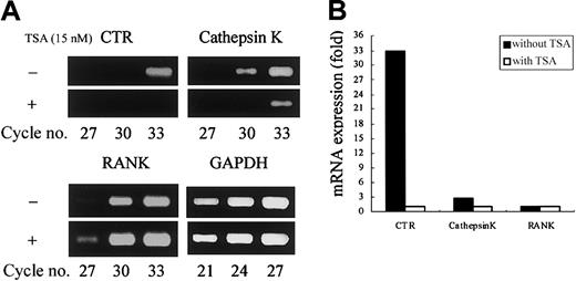 Fig. 2. TSA selectively reduces osteoclast-specific mRNA expression. / (A) Stroma-free rat bone marrow cells were cultured for 4 days with or without 15 nM TSA for the formation of POCs. Total RNA was prepared and reverse transcribed, and cDNA was amplified for the number of PCR cycles, using specific primers designed for genes of CTR, cathepsin K, RANK, and GAPDH. The PCR products were stained with ethidium bromide. (B) Relative expression of CTR, cathepsin K, and RANK is shown. The intensity of the bands was determined by densitometry and normalized by the level of GAPDH.