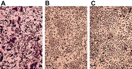 Fig. 3. Demonstration of TRAP+ MNCs in the mouse bone marrow culture treated with sRANKL and M-CSF in the presence of TSA or NaB. / Mouse bone marrow cells were cultured in the presence of hM-CSF (50 ng/mL) and sRANKL (50 ng/mL) with or without TSA or NaB for 4 days. (A) Without TSA or NaB; (B) with 20 nM TSA; (C) with 1 mM NaB. The cells were then fixed and stained for TRAP. A number of TRAP+ MNCs were observed in the culture without TSA or NaB (A). No TRAP+ MNCs were observed in cultures with TSA or NaB (B-C). Scale bars = 100 μm.