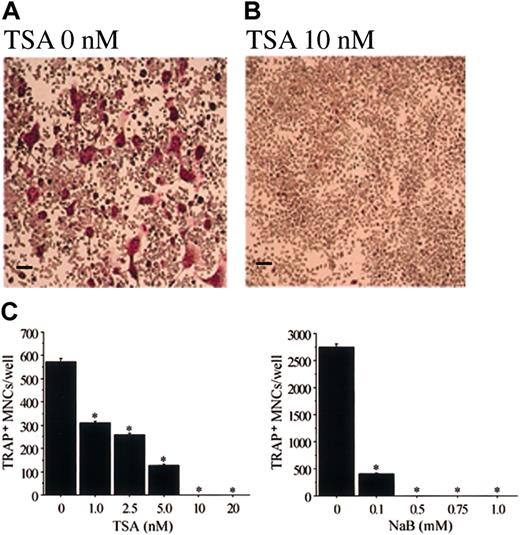 Fig. 8. TSA or NaB inhibits osteoclast differentiation of RAW-D cells stimulated with sRANKL. / Demonstration of TRAP+ cells in RAW-D cells stimulated with sRANKL in the presence (B) or absence (A) of TSA. (C) Dose-dependent effect of TSA or NaB on the formation of TRAP+ MNCs in RAW-D stimulated with sRANKL. RAW-D cells (1.5 × 105 cells/mL) were cultured for 3 days in the presence of sRANKL (30 ng/mL) with various concentrations of TSA or NaB. TSA or NaB was added after 24 hours of incubation. Cells were then fixed and stained for TRAP. The number of TRAP+ MNCs was counted in each well. Each value represents the mean ± SEM of quadruplicate cultures. Data were analyzed by Student t test. *P < .001 compared with the culture without TSA. Scale bars = 100 μm.
