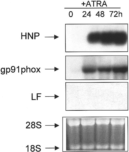 Fig. 4. Northern blot analysis of NB4 cells treated with ATRA. / . RNA (10 μg) isolated from uninduced (0) and ATRA-induced (24, 48, 72 h) NB4 cells were subjected to Northern blot analysis. The blot was sequentially probed with 32P-labeled cDNA probes for HNP, gp91phox, and LF as described in “Materials and methods.” Equal loading of RNA in each lane was determined by the presence of an equal concentration of both 18S and 28S ribosomal RNA in each lane in the ethidium bromide stained gel prior to blotting (bottom panel).