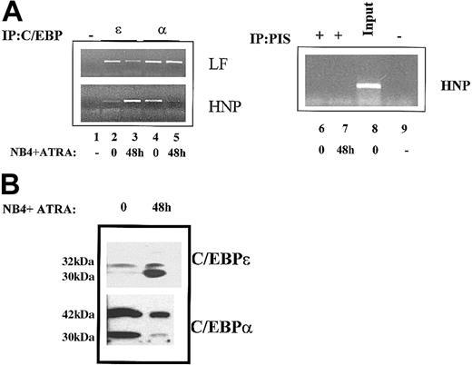 Fig. 5. ChIP analysis of C/EBPα and C/EBPε in the leukemic NB4 cell line. / (A) Chromatin immunoprecipitations were performed from uninduced (0) and ATRA-induced (48 h) NB4 cells using antibodies specific for C/EBPε (lanes 2-3) and C/EBPα (lanes 4-5), a no-antibody control (−) (lanes 1,9), and preimmune serum (PIS) controls (lanes 6-7). The precipitated chromatin was analyzed using primers specific for the human LF (LF) promoter (top panel) and the HNP promoter (bottom panel). Input HNP chromatin (1:10 dilution) is represented in lane 8. This experiment was repeated 3 times. The identities of PCR products obtained were confirmed by dideoxy sequencing. (B) Western blot analysis of whole cell extracts prepared from uninduced (0) and ATRA-induced (48 h) NB4 cells was performed and probed with C/EBPα and C/EBPε antibodies. The molecular weights of the proteins detected are shown in kilodaltons.