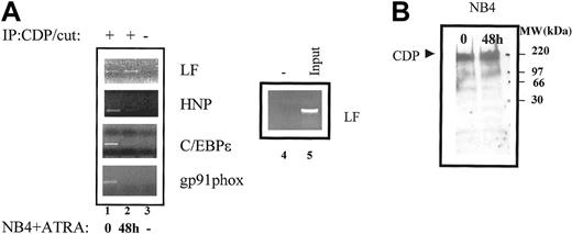 Fig. 6. ChIP analysis of CDP/cut binding to myeloid promoters in NB4 cells. / (A) Chromatin immunoprecipitations were performed from uninduced (0) and ATRA-induced (48 h) NB4 cells using an antibody specific for CDP/cut (lanes 1-2) and a no-antibody control (−) (lanes 3-4). The precipitated chromatin was analyzed using primers specific for the CDP/cut sites in the LF promoter, the HNP promoter, the C/EBPε promoter, and the gp91phox promoter. Input LF/CDP chromatin (1:10 dilution) is represented in lane 5. This experiment was repeated 3 times. The identities of all PCR products obtained were confirmed by dideoxy sequencing. (B) Western blot analysis was performed on 40-μg nuclear extracts prepared from uninduced (NB4; day 0), and 48-hour ATRA-induced (NB4; 48 h ATRA) NB4 cells. The blot was probed with a CDP/cut-specific antibody. The molecular-weight marker is indicated.