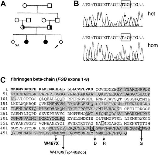 Fig. 1. Prenatal diagnosis for congenital afibrinogenemia. / (A) Family tree. SA: spontaneous abortion. The arrow indicates the fetus undergoing prenatal diagnosis (proband). (B) Partial sequence ofFGB exon 8 demonstrating the FGBTrp467Stop (W467X; TGG>TAG) mutation. Top panel, heterozygote; bottom panel, homozygote Trp467Stop. (C) Amino acid sequence of the fibrinogen beta chain. The Palestinian Trp467Stop mutation identified in this study is shown (bold) as well as the Trp470Stop (W470X) “fibrinogen Mount Eden” mutation19 and 3 missense mutations1820: Leu383Arg, Gly430Asp, and Tyr467Gly. Amino acids encoded by odd-numbered exons 1, 3, 5, and 7 are in normal font; those encoded by even-numbered exons 2, 4, 6, and 8 are highlighted in gray. Amino acids encoded by codons separated in 2 consecutive exons are underlined. Amino acids are numbered from the initiator methionine; those included in the signal peptide are in bold.