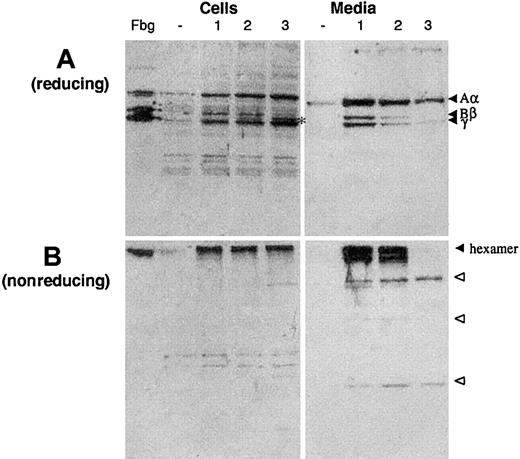 Fig. 2. Western blot analysis of cell extracts and conditioned media of COS-7 cells transfected with fibrinogen cDNAs. / Samples of cell lysates and culture medium were subjected to (A) 10% SDS-PAGE under reducing conditions or (B) 7.5% SDS-PAGE under nonreducing conditions. The blots were incubated with a polyclonal anti–human fibrinogen antibody and cross-reacting bands revealed by chemiluminescence, as described in “Study design.” Fbg indicates purified fibrinogen control; −, COS cells transfected with an empty vector. The positions of the hexameric complex and the normal Aα, Bβ, and γ chains are indicated; open arrowheads indicate probable α/γ intermediates (see “Results and discussion” and Hartwig and Danishefsky17). An asterisk marks the Trp467Stop mutant fibrinogen chain, which lacks 25 amino acid residues from the C-terminus. Transfections, lane 1: normal Aα, Bβ, and γ; lane 2: normal Aα, normal Bβ + mutant Trp467Stop Bβ, and normal γ; lane 3: normal Aα, mutant Trp467Stop Bβ (only), and normal γ.