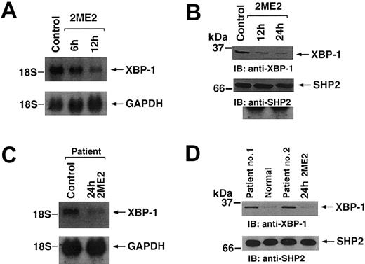 Fig. 3. Effect of 2ME2 on XBP-1 expression. / MM.1S cells were treated with 3 μM 2ME2 for the indicated times. (A) Total cellular RNA was subjected to Northern blot analysis. Data shown is representative of 3 independent experiments with similar results. (B) Total cell lysates were separated by 12.5% SDS-PAGE and analyzed by immunoblotting (IB) with anti–XBP-1 (upper panel) or anti-SHP2 (lower panel) Abs. (C) Purified patient MM cells (CD138+) were treated with 2ME2 for the indicated times and analyzed for mRNA levels by Northern blotting. The blots were reprobed with GAPDH to confirm equal loading. (D) Total cell lysates from purified MM cells (CD138+) (patient 1 and patient 2), normal BM cells, and 2ME2-treated patient cells were separated by 12.5% SDS-PAGE and analyzed by immunoblotting (IB) with anti–XBP-1 (upper panel) or anti-SHP2 (lower panel) Abs.