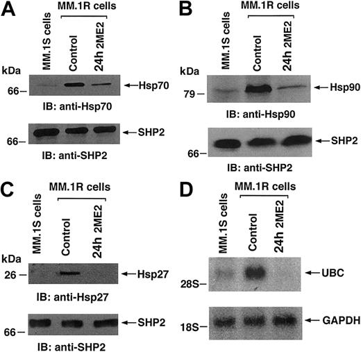 Fig. 6. Effect of 2ME2 on genes encoding Hsps and ubiquitin in Dex-sensitive (MM.1S) and Dex-resistant (MM.1R) MM cells. / MM.1R cells were treated with 3 μM 2ME2 for the indicated times. (A-C) Total cell lysates were separated by 12.5% SDS-PAGE and analyzed by immunoblotting (IB) with anti-Hsp70, anti-Hsp90, or anti-Hsp27 Abs (upper panels) or anti-SHP2 (lower panels) Abs. (D) Total cellular RNA from MM.1S, MM.1R, and 2ME2-treated MM.1R cells was hybridized to 32P-labeled ubiquitin (UBC) and GAPDH cDNA probes.