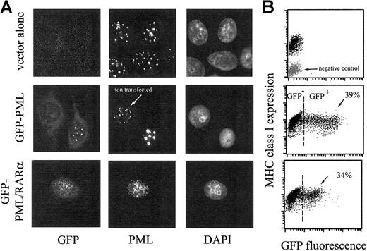 Fig. 1. MHC class I expression is not affected by PML/RARα, a dominant-negative mutant of PML. / (A) HeLa cells were transfected with the retroviral vector pBABE alone (top row), with pBABE containing GFP-PML (middle row), or GFP-PML/RARα (bottom row), using the Lipofectamine 2000 procedure. At 3 days after transfection, cells were processed for fluorescence microscopy and flow cytometry. Cells growing on glass coverslips were immunostained with anti-PML followed by GAM-Alexa 594 antibodies (red fluorescence, middle column) and counterstained with DAPI (blue fluorescence, right column). GFP green fluorescence is shown in the left column. Cells processed for flow cytometry were immunostained with anti–MHC class I mAb (W6.32) followed by GAM-PE. (B) Bivariate dot plots are shown: x-axis, green fluorescence; y-axis, red fluorescence. Percentage of GFP-positive cells (ie, of transfected cells) is reported. The negative control for MHC class I expression, obtained using isotype-matched antibodies followed by GAM-PE, is shown in gray.