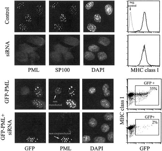 Fig. 2. MHC class I expression is not affected by PML-specific RNA interference. / HeLa cells were transfected with PML-specific siRNA duplex (second row), with GFP-PML (third row), or cotransfected with siRNA duplex and GFP-PML (fourth row) using the Oligofectamine procedure. Control cells in the first row were treated with Oligofectamine alone. At 48 hours after transfection, cells were processed for fluorescence microscopy and flow cytometry. Cells growing on glass coverslips were immunostained with anti-PML mAb followed by donkey antimouse FITC and anti-SP100 mAb followed by donkey antigoat Cy3 (control and siRNA duplex-treated samples, first 2 rows), or with anti-PML mAb only, followed by GAM-Alexa 594 (samples transfected with GFP-PML, last 2 rows). The green fluorescence is shown in the first column, the red fluorescence in the second, and the blue fluorescence from DAPI in the third. In the fourth row, a microscopic field comprising one of the few GFP-positive cells was chosen, which presumably was not transfected with siRNA but only with GFP-PML, to emphasize the disappearance of PML-containing NBs induced by RNA interference. Cells processed for flow cytometry were immunostained with anti–MHC class I mAb (W6.32) followed by GAM-PE. Data are reported in the fourth column as histograms of MHC class I expression (top 2 rows, negative control provided by isotype-matched mAb indicated in gray) and bivariate dot plots (bottom 2 rows) of GFP fluorescence (x-axis) and MHC class I expression (y-axis).