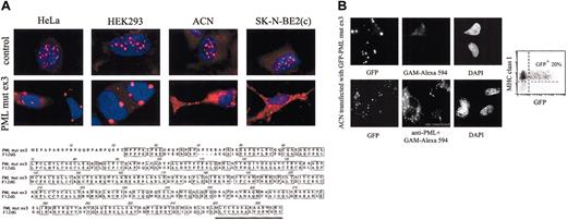 Fig. 3. PML mut ex3 induces cytoplasmic localization of PML molecules and does not affect MHC class I expression. / (A) Cells growing on glass coverslips were either untreated (top row) or transfected with PML mut ex3 (bottom row) by the Lipofectamine 2000 procedure. At 2 days after transfection, cells were stained with anti-PML mAb followed by GAM-Alexa 594 (red) and counterstained with DAPI (blue). Localization of PML molecules in relation with the cell nucleus was achieved by merging the 2 fluorescence pictures. The amino-acid sequences of the PML mut ex3 protein and of the murine PML mutant F12dG are compared. Both mutants arise from a point deletion in exon 3 of the PML gene that causes a frameshift and translational termination of PML proteins at exon 3. The 16-aa string underlined at the C-terminus of both proteins corresponds to the sequence that derives from the mutation-induced frameshift and that is not present in wt PML. (B) ACN cells were transfected with GFP-tagged PML mut ex3. At 2 days after transfection, cells were processed for microscopic and flow cytometric analyses. Cells growing on glass coverslips were immunostained with GAM-Alexa 594 (middle column) either alone (top row) or preceded by anti-PML mAb (bottom row) and counterstained with DAPI (right column). GFP fluorescence is shown in the left column. Of note is the presence of one untransfected cell that was negative for GFP and displayed a PML pattern typical of NBs after immunostaining with anti-PML mAb. Cells processed for flow cytometry were immunostained with anti–MHC class I mAb (W6.32) followed by GAM-PE. In the bivariate dot plot of GFP (x-axis, green fluorescence) versus MHC class I (y-axis, red fluorescence), the percentage of GFP-positive cells (ie, of transfected cells) is reported. The negative control for MHC class I expression, obtained using isotype-matched antibodies followed by GAM-PE, is shown in gray.