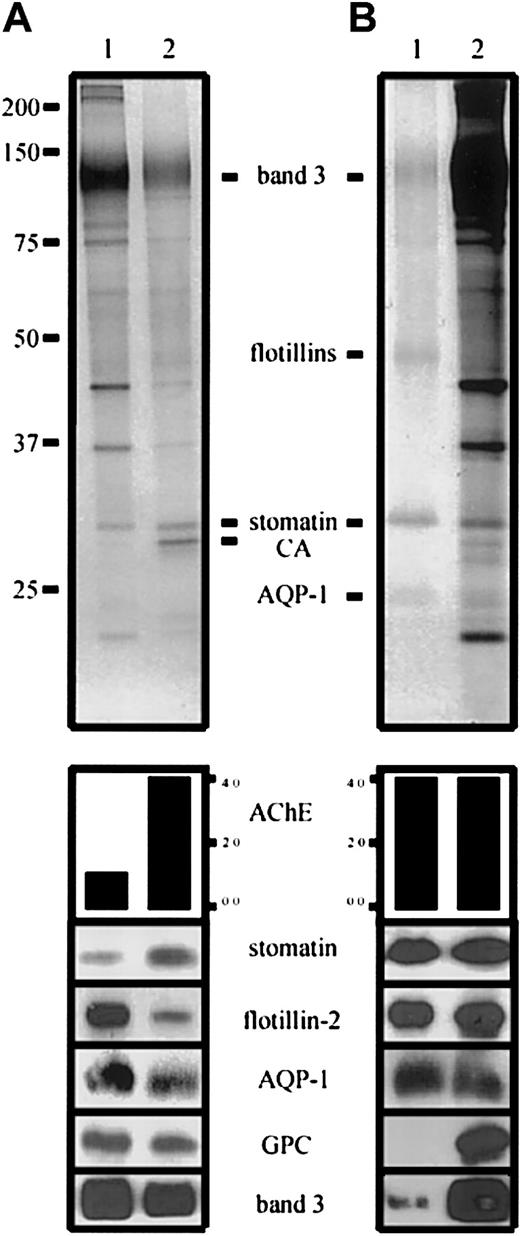 Fig. 1-1. Distribution of erythrocyte membrane proteins in microvesicles and lipid rafts. / (A) Erythrocyte membranes (lane 1) and microvesicles (lane 2) were prepared and AChE activity determined as described.1-5Aliquots were loaded on an 11% polyacrylamide gel, with a 4-fold AChE activity in the microvesicular sample, and analyzed by silver staining (upper panel) and Western blotting, as indicated and previously described1-5 (anti–AQP-1 was from Calbiochem, La Jolla, CA). AChE activity is given in arbitrary units. Note the differential distribution of stomatin and flotillin-2. (B) Erythrocyte lipid rafts were prepared by method B1-1 and AChE activity was determined. Aliquots with equal AChE activity of lipid rafts (lane 1) and erythrocyte membranes (lane 2) were loaded on an 11% polyacrylamide gel and analyzed by silver staining (upper panel) and Western blotting, as indicated. CA indicates carbonic anhydrase; GPC, glycophorin C; and AQP-1, aquaporin-1.