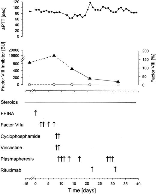 Fig. 1. Multimodal treatment of acquired factor VIII inhibitor. / Time course of activated partial thromboplastin time (aPTT, ●), factor VIII (○), and factor VIII inhibitor (▴). A rapid decline in factor VIII inhibitor is accomplished by plasmapheresis. FEIBA indicates factor VIII inhibitor bypassing activity.