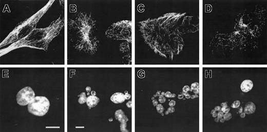 Figure 4. 2ME2 alters tubulin organization in a BCR-ABL—transformed cell line. NIH3T3.p210 cells were treated with DMSO (A,E), 5 μM 2ME2 (B,F), 1 μM paclitaxel (C,G), or 1 μg/mL nocodazole (D,H) for 24 hours, washed, and fixed as described. Immunofluorescence analysis was performed using anti—α-tubulin antibodies (A-D) and DAPI (E-H). Bars = 10 μm.