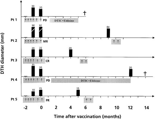Figure 4. The immune response to KLH is long-lived. DTH diameter in millimeters before vaccination, after 4 and 6 cycles of vaccination, and at different time points after the last vaccination. Symbols: ↑ indicates DC vaccination cycle; †, time of death; CR, complete response, PR, partial response; MR, minor response; and PD, progressive disease.