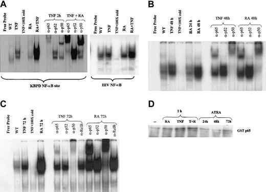 Figure 2. ATRA regulation of NF-κB binding. EMSAs and supershift assays showing binding to a palindromic NF-κB response element using nuclear extracts from NB4 cells treated with ATRA and TNF for various times. (A) ATRA is seen to heighten TNF-induced NF-κB binding after 2 hours and to increase these complexes alone after 48 and 72 hours (B-C). Supershift assays indicated that complexes induced by ATRA were composed primarily of p65 and p50 proteins. (D) In vitro kinase assay using GST-p65 as a substrate. While a slight increase in p65 phosphorylation is observed in response to TNF, no change is seen in response to ATRA.