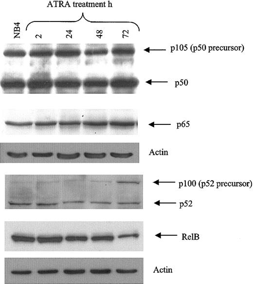 Figure 3. NF-κB protein levels in NB4 cells. Western blot of NF-κB protein levels in NB4 cells in response to RA demonstrates that increased NF-κB binding in response to ATRA is not attributed to increased NF-κB family member levels. NB4 whole cell extract (30 μg) was analyzed for NF-κB subunit levels in response to ATRA for the time periods indicated. Antibodies were used at a dilution of 1:500.