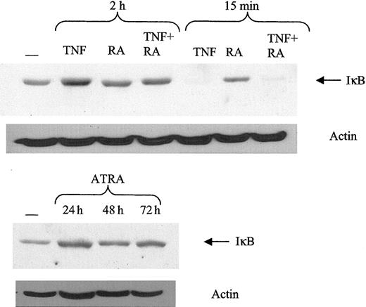 Figure 4. Response of IκB to ATRA and TNF. ATRA does not promote IκB degradation. Protein levels of IκB were determined using Western blotting of 30 μg whole cell extract. Typical IκB degradation was observed in response to TNF at 15 minutes after treatment.