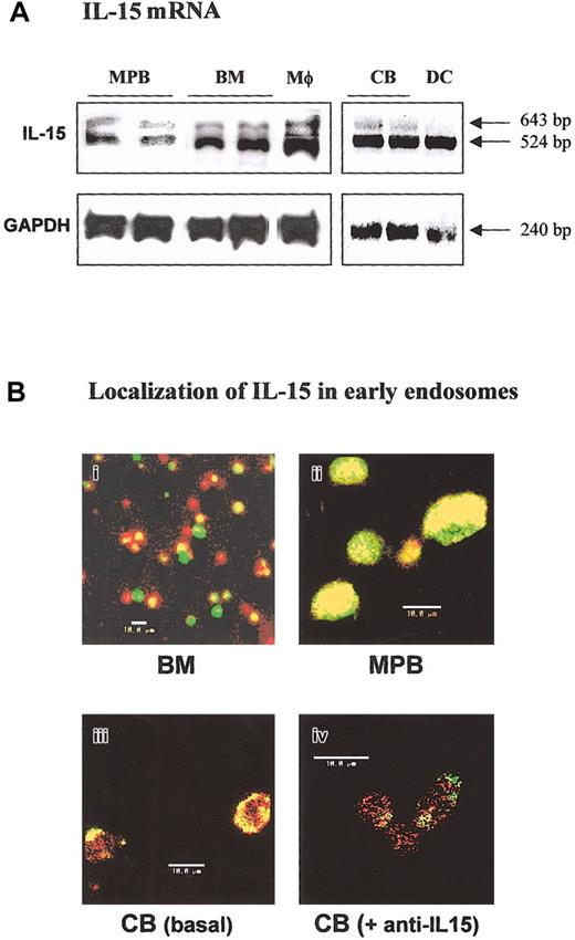 Figure 1. Analysis of IL-15 expression in human CD34+ cells from various sources. (A) Expression of mRNA transcripts for IL-15 in human CD34+ cells by RT-PCR. Two amplification products for the IL-15 gene (643 and 524 bp) were detected in hematopoietic progenitors isolated from G-CSF—mobilized peripheral blood (MPB), bone marrow (BM), and cord blood (CB). As positive controls, LPS-activated macrophages (Mφ) and dendritic cells (DCs) were used. The housekeeping gene GAPDH (240 bp) was used as an internal control. (B) Confocal microscopic analysis of intracellular IL-15 localization in BM (i), MPB (ii), and CB (iii-iv) CD34+ cells by using anti—IL-15 mAb M111 (red staining) and FITC-transferrin as markers of early endosomes (green staining). The pictures are overlay-compacted images of serial optical sections of 1-μm thickness from the outside of the cells toward the inner compartments. Yellow staining at the submembrane level shows the localization of some endogenous IL-15 inside the early cell endosomes. The effects of neutralizing anti—IL-15 mAb on intracellular IL-15 localization in early endosomes are shown in lower panels iii and iv. The loss of yellow staining confirms that neutralizing mAb inhibits the retrapping of endogenously secreted IL-15 in CB CD34+ cells (panel iv). These data are representative of 3 different experiments.