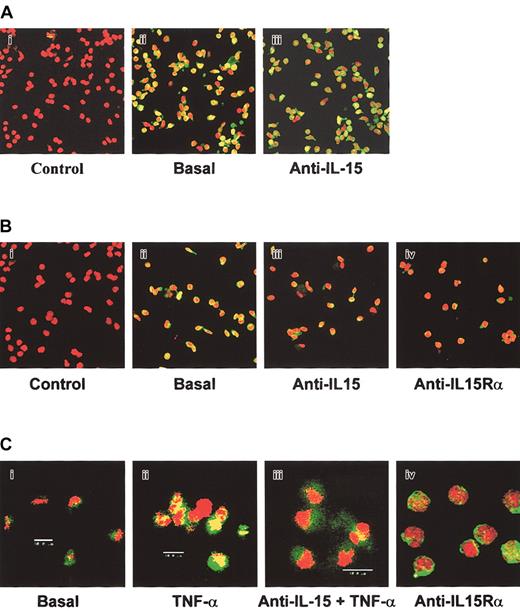 Figure 4. Analysis of NF-κB p65 nuclear localization in human CD34+ cells from various sources by confocal microscopy. Hematopoietic progenitors isolated from BM (A), CB (B), and MPB (C) were incubated or not (basal) with neutralizing anti—IL-15 or anti—IL-15Rα mAbs for 1 hour and were analyzed by confocal microscopy (original magnification, × 63), for NF-κB p65 expression and nuclear localization. MPB progenitors were also stimulated with TNF-α for 15 minutes. Cells were permeabilized and labeled with anti—NF-κB p65 antibodies, followed by incubation with Alexa Fluor488-GARa antibody. Propidium iodide stained the nuclei in red, and NF-κB p65 stained in green. As negative controls, cells were incubated with only the second reagent and propidium iodide. These data are representative of 3 different experiments.