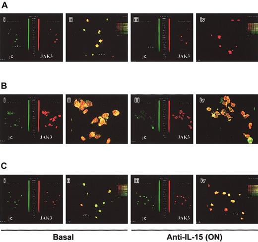 Figure 5. Analysis of the expression of the γc chain and JAK3 in normal human CD34+ cells and effects of anti—IL-15 mAb. Confocal microscopy on overlay pictures (original magnification, × 63) shows the presence of γc chain (green) and JAK3 (red) in BM, MPB, and CB CD34+ cells. Yellow staining demonstrates that the 2 molecules almost totally colocalize in BM (A) and MPB (B), but not in CB CD34+ cells, where there is only a partial overlapping of the 2 molecules (C). Side-side pictures of the previous picture shows that the expression of γc (totally) and JAK3 (partially) is inhibited after overnight treatment with neutralizing anti—IL-15 mAb in BM (Ai) but not in MBP (B1) and CB (C1) hematopoietic precursors. However, in MBP precursors, anti—IL-15 treatment prevents colocalization of the JAK3 and the γc chain in 30% of the cells in the field. These data are representative of 3 different experiments.