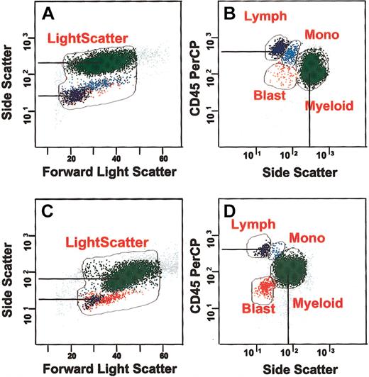 Figure 2. Light scatter and CD45 abnormalities in MDS. (A-B) Normal granularity is measured as the log difference of SSC between maturing myeloid cells and the normal lymphocytes present. (C-D) A dysplastic marrow illustrates decreased granularity and shows SSC nearly a half log lower than normal, as indicated by lines. In addition, the myeloblasts show abnormally decreased CD45 expression.