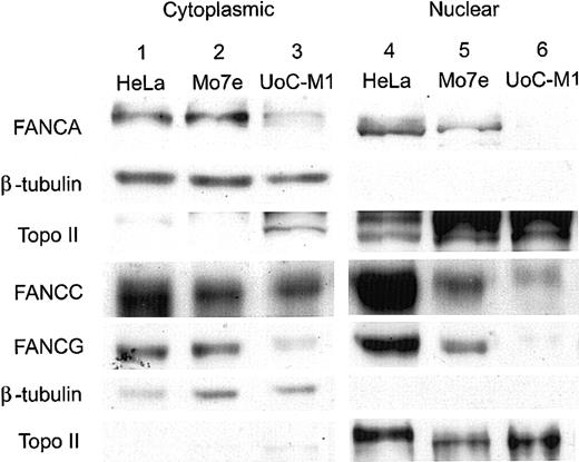Figure 4. Nuclear FA proteins are reduced in UoC-M1 cells. Immunoblots of cytoplasmic and nuclear components were probed with antisera for the FANCA, FANCC, and FANCG proteins. Compared with the human, cervical carcinoma cell line HeLa (lane 1) and the factor-dependent, myeloid cell line Mo7e (lane 2), UoC-M1 (lane 3) has a mild reduction in the levels of cytoplasmic FANCA, FANCC, and FANCG proteins (rows 1, 4, and 5, respectively). Nuclear fractions (lanes 4-6) demonstrated a reduction of FANCC in UoC-M1 (row 4, lane 6) and a nearly complete absence of nuclear FANCA (row 1, lane 6) and FANCG proteins (row 5, lane 6). Purity of nuclear fractions was confirmed by reprobing the filters with antisera against beta-tubulin (rows 2 and 6) and topoisomerase II (rows 3 and 7).