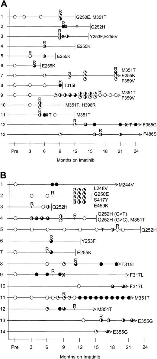 Figure 1. Mutation analysis in patients with mutations. (A) Patients in AP. (B) Patients in late-CP. Open circles represent wild-type BCR-ABL sequence. The degree of shading indicates the relative percentage of mutant compared with wild type. T indicates transplantation (refer to Tables 2 and 3 for transplantation details), X indicates that imatinib was withdrawn, terminated lines indicate the month the patient died, and arrows indicate that the patient is alive. R indicates when acquired imatinib resistance was evident. For space considerations, the mutations are shown in the figure with single-letter codes rather than 3-letter codes. For patients with multiple mutations the top circle corresponds to the amino acid with the lowest number, eg, in panel A, patient 1, the top circle corresponds to Gly250Glu and the lower circle Met351Thr. The double shading in panel B, patient 4, represents 2 mutations at the same nucleotide; no wild type was detected.