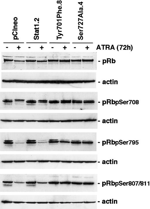 Figure 6. The level of hyperphosporylated pRB is maintained after ATRA treatment in cells expressing Stat1Ser727Ala or Stat1Tyr701Phe. U-937 sublines were induced by ATRA for 72 hours, whole cell lysates were prepared, and the levels of total pRb or Ser780-, Ser795-, or Ser807/811-phosphorylated pRb were determined by Western blot analysis using phosphospecific antibodies.