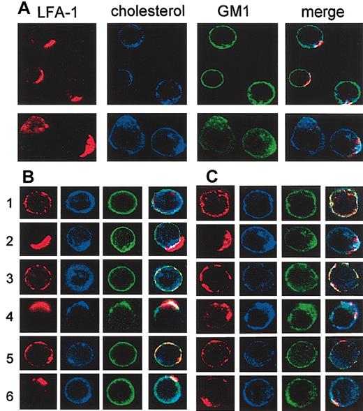 Figure 7. Confocal microscopic analysis of cocapping of LFA-1 and cholesterol. (A) Splenic T cells (upper row) and T28 cells (lower row) were stained with anti–LFA-1 and Alexa Fluor 568–conjugated goat anti-rat secondary antibody (red) and incubated at 37°C for 30 minutes to induce capping of LFA-1. The cells were then stained at 4°C for cholesterol with filipin (blue) and for GM1 with FITC-CTxB (green), fixed with formaldehyde, and analyzed by confocal microscopy. Images of midlevel sections of the cells are shown. Merge images are shown in the right-most columns. Results are representatives of multiple cells in 3 independent experiments. (B) Primary T cells were either untreated (rows 1, 3, and 5) or subjected to antibody cross-linking to induce capping of LFA-1 (row 2), Thy1 (row 4), or CD45 (row 6). The cells were then stained in 3 colors for cholesterol (blue), GM1 (green), and either LFA-1, Thy1, or CD45 (red) and analyzed by confocal microscopy as in panel A. (C) The T28 cell line was analyzed as in panel B. The images were captured with a × 60 objective lens, and the final magnifications in the figure are approximately × 1000 for primary T cells and × 500 for T28.