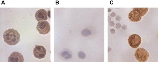 Figure 7. Chemokine MCP-1 expression in peritoneal macrophages. Immunohistochemical analysis of (A) MCP-1 expression in untreated endogenous peritoneal macrophages using anti–MCP-1 mAb. (B) IgG2b control mAb. (C) F4/80 mAb selective for murine macrophages. Original magnification, × 40.