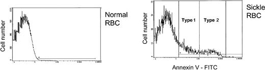 Figure 1. Normal or sickle RBCs were reacted with annexin V-FITC to detect external PS. Positive cells were divided into those with low (type 1) or high (type 2) external PS. The horizontal line in each panel shows the gate for PS+ cells.
