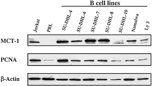 Figure 2. Steady-state MCT-1 protein levels in a panel of transformed B-cell lines derived from patients with non-Hodgkin lymphoma. Western blotting was performed with MCT-1 polyclonal antibody on 40 μg total protein from 7 transformed B-cell lines. Results showed that most B-cell lines expressed high levels of MCT-1 protein and that MCT-1 levels are closely correlated with PCNA expressions in these cell lines. Jurkat and PBL cells served as positive and negative controls for MCT-1 signals, respectively.