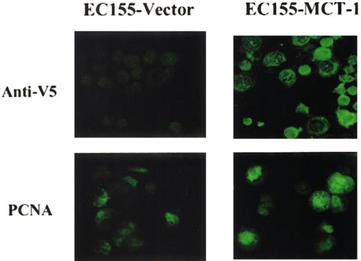 Figure 5. Confocal immunofluorescence microscopy of EC155 cell lines. EC155-Vector5 and EC155—MCT-17 cells were fixed with methanol and incubated with blocking solution and primary antibody, mouse monoclonal anti-V5, or anti-PCNA. Next, secondary antimouse IgG2a-fluorescein was used for hybridization. Cells were spread on slides and mounted on coverglass with mounting medium. Slides were examined using a Zeiss LSM510 confocal scanning laser microscope. Results showed that MCT-1 overexpressing cells had elevated PCNA protein levels compared with control. Original magnification, × 40.
