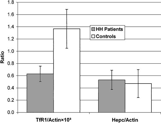Figure 1. Hepatic TfR1/Actin × 103 and Hepc/Actin ratios in patients with HH and control individuals. The mean values are shown (± 95% confidence intervals). The TfR1/Actin × 103 ratio differed significantly between patients with HH and control individuals (P < .001).