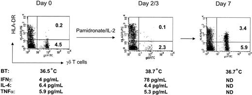 Figure 1. Representative example demonstrating activation and expansion of γδ T cells during pamidronate/IL-2 treatment. Peripheral blood lymphocytes (PBLs) of patient 4B were stained with FITC- and PE-labeled antibodies and analyzed by flow cytometry before and after infusion of pamidronate and IL-2. Percentages of cells are given per quadrant. Body temperature (BT) was measured 2 times daily. Cytokine concentrations were determined in serum using ELISA systems. ND indicates not done.