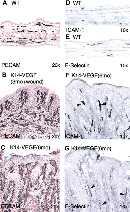 Figure 4. Hyperplastic and inflamed cutaneous blood vessels in K14-VEGF transgenic mice. Immunostaining was performed on cryosections of ear skin from wild-type littermate controls (A, D-E) and transgenic mice (B-C, F-G). PECAM staining showed increased vascular density mostly in the papillary dermis in wound-induced psoriasis in the 3-month-old transgenic mice (B). Enlarged vessels in 6-month-old transgenic mice showed vessels enclosed by anastomosing epidermal rete ridges (C). Immunostaining of E-selectin (G) and ICAM-1 (F) showed positive signals on dermal microvessels in transgenic mice (arrowheads). Original magnifications: Ă— 20 (A-C); and Ă— 10 (D-G).