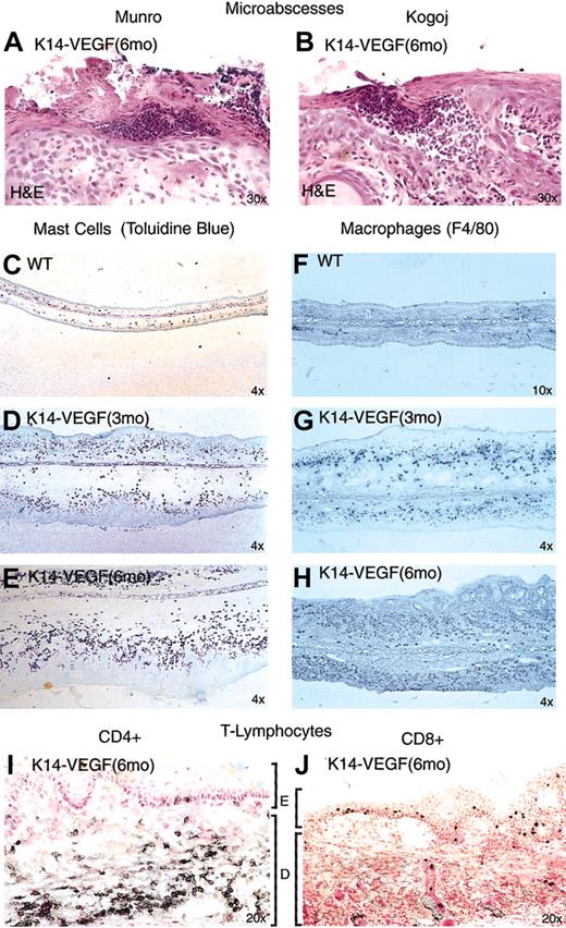 Figure 6. K14-VEGF mice exhibit epidermal microabscesses and inflammatory infiltrates characteristic of human psoriasis. (A) Munro-like microabscess. (B) Kogoj-like microabscesses. Progressive increase of mast cell (C-E) and macrophage (F-H) density with 3-month-old (D, G) and 6-month-old (E, H) transgenic mice compared with wild-type littermates (C, F). CD4+ T-lymphocytes were detected primarily in the dermis (I) and CD8+ T-lymphocytes in the epidermis of 6-month-old transgenic mice (J). E indicates epidermis; D, dermis.