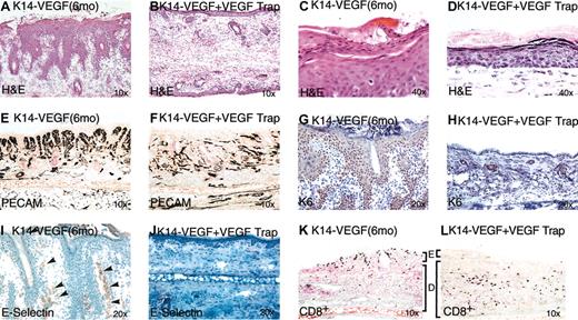 Figure 7. VEGF Trap normalizes the psoriatic phenotype in K14VEGF transgenic mice. Transgenic mice with severe skin lesions were injected with VEGF Trap (25 mg/kg) on days 0, 3, 7, and 12. Tissue was harvested on day 14 for histologic analysis. H&E staining of mouse ear skin treated with VEGF Trap showed clear resolution of rete ridges (compare panels A and B) and decreased parakeratosis/hyperkeratosis (compare panels C and D). Immunostaining with PECAM showed a drop-off of microvessels in the papillary dermis (compare panels E and F). Immunostaining with keratin K6 and E-selectin each showed remarkable down-regulation of signals in the epidermis (compare panels G and H), dermal capillaries (compare panels I and J), respectively. Arrowheads in panel I denote positive staining of blood vessels for E selectin. CD8+ T-lymphocytes shifted localization from the epidermis to the dermis in treated animals (compare panels K and L). E indicates epidermis; D, dermis.