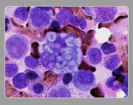 Peter Maslak, Memorial Sloan-Kettering Cancer Center