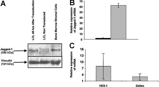 Figure 2. Jagged-1 expression in Ad5/F35-Jagged-1-transduced EBV-LCL cells. Transduction efficiency of EBV-LCLs using Ad5/F35-Jagged-1 was monitored after 48 hours by Western blotting and RQ-PCR. (A) Jagged-1 protein (≈180 kDa) was detected in EBV-LCLs 48 hours after transduction by Ad5/F35-Jagged-1 vector. Human bone marrow stromal cells were used as the positive control for Jagged-1 protein expression. (B) RQ-PCR assay showed a mean 62-fold higher quantity of Jagged-1 mRNA in EBV-LCLs after transduction by Ad5/F35-Jagged-1 vector (gray bar), compared with control-transduced EBV-LCLs (black bar) (mean ± SD of 3 experiments). (C) To confirm the functionality of Jagged-1 expressed on transduced LCLs, T-cell populations were analyzed for HES-1 and Deltex mRNA content after 12 hours of activation in an MLC (mean ±SD of 3 experiments).