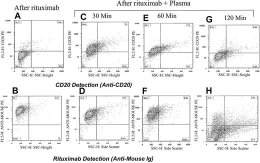 Figure 5. Down-modulation of CD20 increases with increasing incubation time with plasma. Adding rituximab to cells from a patient with CLL masks the detection of CD20 (A) and shows strong positivity for rituximab (antimouse Ig; B). Incubating the cells with rituximab and the patient's plasma for 30 minutes partially reduced the detection of CD20 (C) and rituximab is easily detected on the surface of cells (D). The same cells when analyzed 1 hour after incubation with rituximab and plasma became less positive for CD20 (E) and remained strongly positive for rituximab (F). After 120 minutes the cells became completely negative for both CD20 (G) and rituximab (H). The percentage of cells in each quadrant is shown.