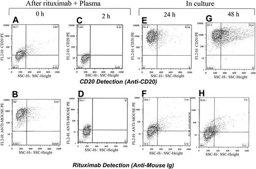 Figure 9. Restoring CD20 expression in Raji cells within 24 hours after exposure to rituximab. Rituximab and plasma were first added to Raji cells and the CD20 was masked (A) and rituximab was detected on the surface of cells (B). After 2 hours of incubation with plasma from a healthy individual, the CD20 was down-modulated (C) and a low level of rituximab was detected on the surface of cells (D). Cells were washed and kept in culture media. After 24 and 48 hours, most cells became positive for CD20 (E,G). Rituximab was detectable on the surface of cells in some cells (F,H). The percentage of cells in each quadrant is shown.