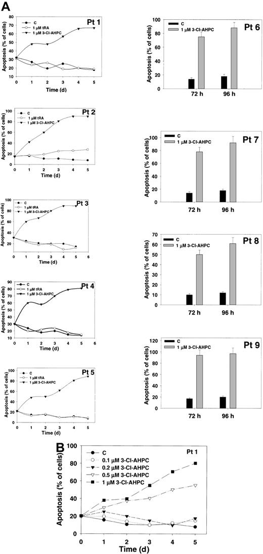 Figure 2. 3-Cl-AHPC and tRA induction of apoptosis of leukemic blasts. Leukemia cells obtained from patients were cultured as described in “Materials and methods.” The results represent the mean of 3 independent experiments, with the variation between the experiments being less than 10% if error bars are not shown. Error bars represent standard deviations. (A) The 3-Cl-AHPC or tRA induction of apoptosis. The 3-Cl-AHPC and tRA were added to a final concentration of 1 μM; the cells were harvested at various times, and the percentage of apoptotic cells was assessed as described in “Materials and methods.” (B) Leukemic cells of patient 1 were exposed to varying concentrations of 3-Cl-AHPC for up to 5 days.