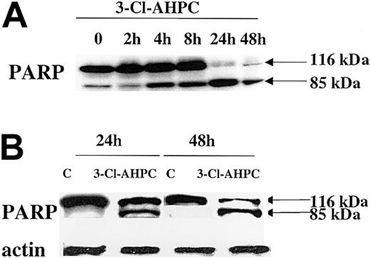 Figure 6. PARP cleavage. PARP cleavage occurs during 3-Cl-AHPC-mediated apoptosis. M07e (A) and leukemic cells (B) obtained from patient 10 were exposed to 1 μM 3-Cl-AHPC for indicated times; cells were harvested; and Western blots were performed as described in “Materials and methods.”
