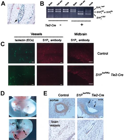 Figure 2. Characterization of mice with EC-specific S1P1 deletion. (A) Section of X-gal stained Tie2-Cre/ROSA26 E10.5 brain vessel showing lacZ staining specifically in ECs. (B) Tissue specificity of Tie2-Cre-mediated recombination of S1P1loxP using E12.5 embryo tissue DNA samples and PCR primers as shown in Figure 1B. In embryos carrying the Tie2-Cre gene, substantially more recombination of the S1P1loxP allele to produce the S1P1ΔEx2 allele was found in yolk sac and aorta as compared with embryonic neural tissue. No evidence of recombination was found in embryos without the Tie2-Cre gene. S1P 1 loxP, S1P1 allele containing loxP sites; S1P1ΔEx2, S1P1 allele after Cre-mediated recombination; S1P1WT, wild-type S1P1 allele; S1P 1Ko, null S1P1 allele.15 (C) S1P1 expression in ECs in control and S1P1loxP/Ko Tie2-Cre embryonic brains at E12.5. Sections were stained with both isolectin B4-fluorescein isothiocyanate (FITC; Vector Laboratories, Burlingame, CA), a specific marker for mouse ECs, and the anti-S1P1 antibody. Note that in control section essentially all ECs that are stained with isolectin B4 also stain with the antibody to S1P1. In the section from the S1P1loxP/Ko Tie2-Cre conditional mutant, only a few ECs stain strongly with the S1P1 antibody. Midbrain neuroepithelia from control and S1P1-conditional E12.5 embryos shown as positive control for S1P1 expression; both show about equal staining. (D) Phenotype of S1P1-conditional mutant embryos. At E13.5, the yolk sacs of S1P1loxP/Ko Tie2-Cre conditional mutant embryos show normal vasculature but less blood compared with control embryos (top, arrowhead). The mutant embryos display an enlarged pericardial cavity (PCC; right), undeveloped limbs, and intraembryonic hemorrhages (bottom; FL, front limb; HL, hind limb). (E) Vascular maturation in S1P1-conditional mutant embryos. Transverse sections of aortae (top) from an S1P1loxP/KO Tie2-Cre embryo and a control embryo stained with anti-SM α-actin (DAKO, Carpinteria, CA). Note VSMCs are clustered to the ventral side of the aorta and fail to surround the vessel completely in the mutant. Also, ECs on the dorsal side of the aorta appear discontinuous (arrows). Cranial arteries (bottom) from S1P1loxP/Ko Tie2-Cre and control embryos stained with anti-SM α-actin. Note that VSMCs cluster on one side of the vessel of the S1P1-conditional mutant embryo. Scale bars = 50 μm.
