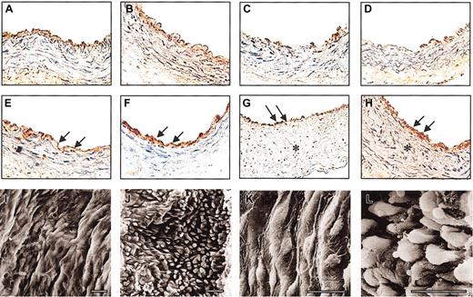Figure 2. Histologic analysis of time-dependent re-endothelialization in murine carotid artery. Typical observations of endothelial cells stained by anti-VWF antibodies in the carotid artery of α2-AP-/- (B,D,F,H; original magnification, × 400) and in α2-AP+/+ mice (A,C,E,G; original magnification, × 400). Before the initiation of injury, an intact endothelial cell layer was observed (A-B). Endothelial cells were removed by the injury (C-D). Regenerated endothelial cells (arrows) only partly covered the injured area in wild-type mice (E); however, an obvious compact endothelial cell layer (arrows) developed on the injured surface in α2-AP-/- mice (F) 2 days after injury. Four weeks after injury, a neointimal thickening (*) had developed in the injured area. A regenerated endothelial cell layer (arrows) was observed on the neointima in wild-type mice (G) and in α2-AP-/- mice, in which the endothelial cell layer (arrows), however, was thicker (G). Scanning electron photomicrographs of regeneration of endothelial cells in the injured carotid artery 48 hours after injury in α2-AP+/+ mice (I,K) and in α2-AP-/- mice (J,L) showed prompt and intense re-endothelialization in α2-AP-/- mice. The white bar represents 10 μm.